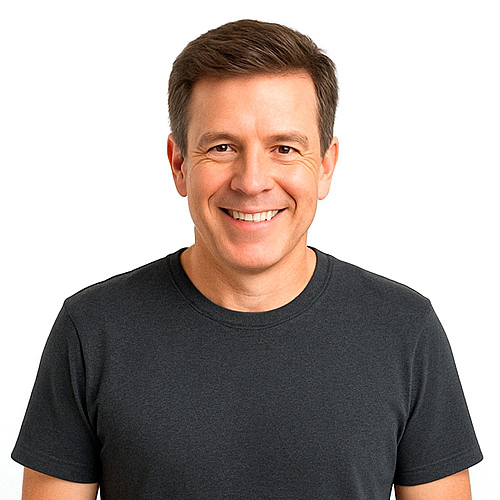 12 meses resultados injerto capilar